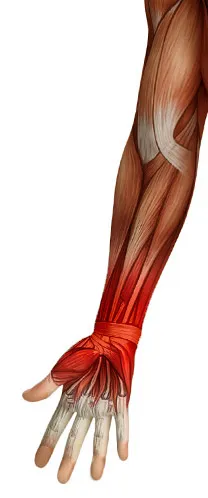 Strain-Injury Strain-Injury